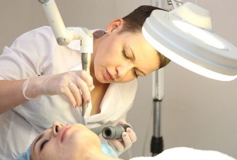 Entfernung des humanen Papillomavirus mit Laser
