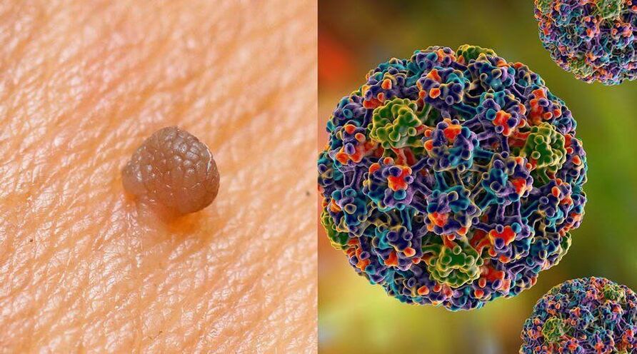 HPV-Übertragungswege